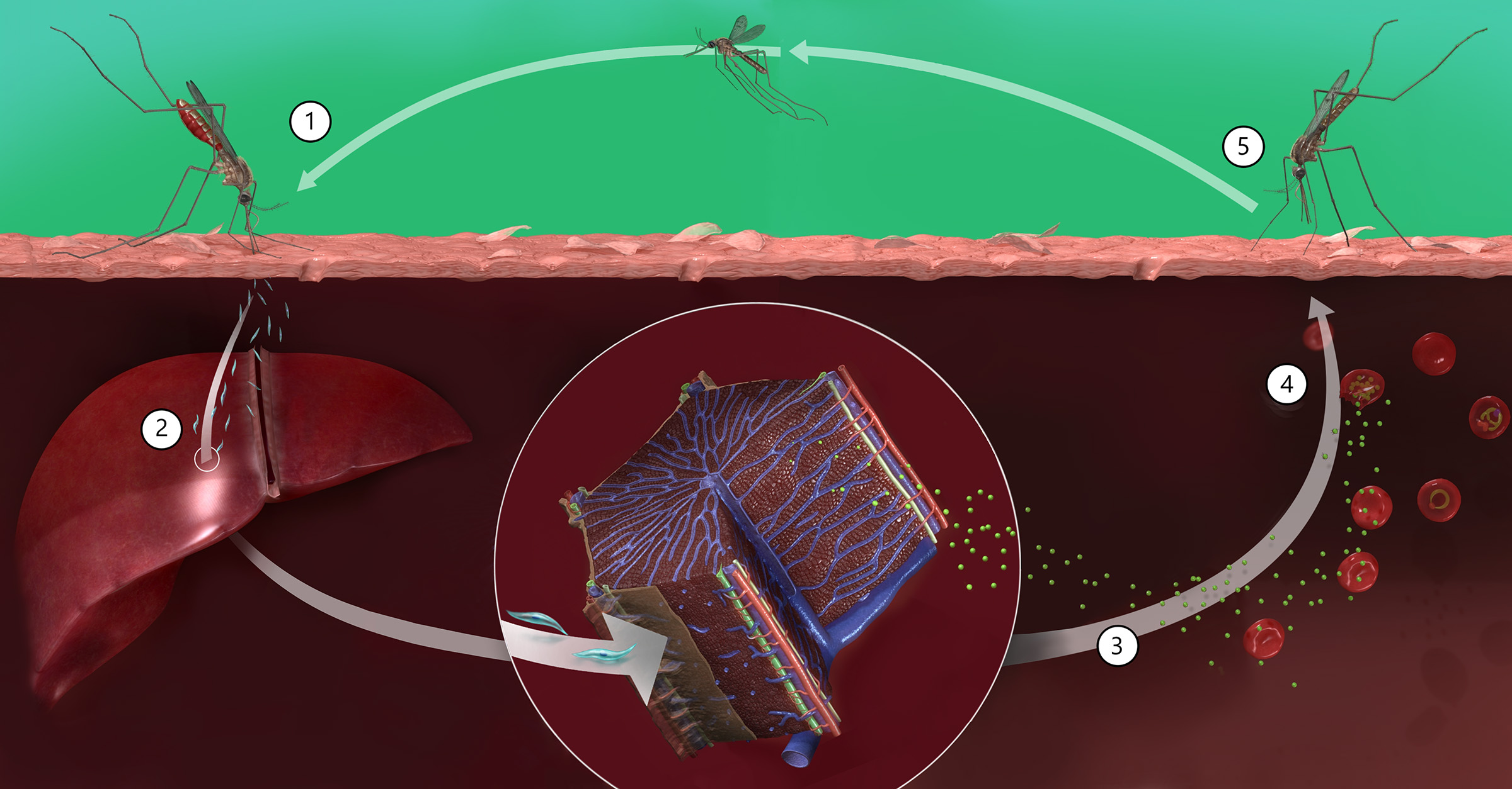 Image showing the malaria parasite life cycle. (1) Infected mosquito bites skin. (2) Parasites infect liver. (3) Liver releases parasites. (4) Parasites infect red blood cells. (5) Uninfected mosquito bites skin and becomes infected, and the cycle repeats.